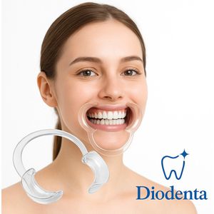 Diodenta - 10 Stuks maat M - Cheek retractor - Mondspreider professioneel - Tandenbleek spreider - Dental mondopener - Mond retractor - Lippen spreider - Bleaching mondspreider - Tandenbleek hulpmiddel - Mondopener - Mondopener - hulpmiddel
