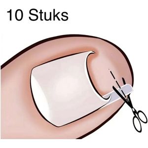 Nagelpads Tegen Ingegroeide Teennagels - 10 Stuks - Teennagel Corrector - Teennagel Lift - Teennagel Kussentjes - Siliconen - Voor Alle Tenen