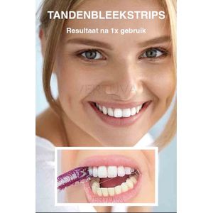 Whitening strips voor Gevoelige Tanden en Gebit - 14x stuks - Whitening Strips for Sensitive Teeth - Tanden bleken strips - Wit gebit - Witte tanden - Easy strips