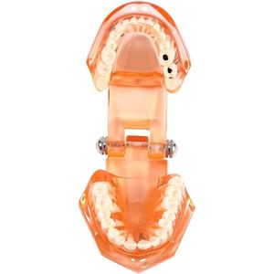 Verwijderbaar tandheelkundig implantaat model met instelbare hoek - tandarts demonstratiemodel voor tandheelkundige studieonderwijs