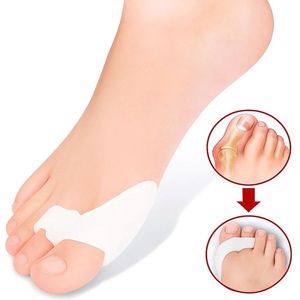 Siliconen Teencorrector I Teenspreider I Hallux Valgus I Grote en Kleine Teenbeschermer I 1 Paar