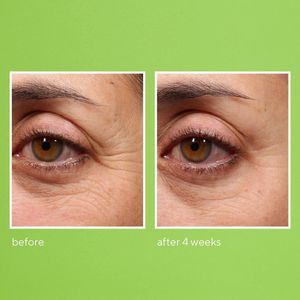 Murad - Retinol Youth Renewal Eye Serum - Rimpels en kraaienpootjes