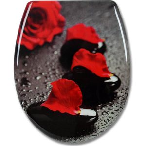 Soft-Close Toiletbril - Duroplast Deksel - Rose Dream Motief - Antibacterieel - 45,5 cm x 37,1 cm x 1,8 cm - Hoge stabiliteit, roestvrije scharnieren