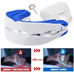 Anti Snurk - Snurkbeugel - Wit met Blauw - Anti Snurk Producten