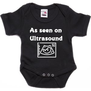 Romper As seen on ultrasound (maat 80)