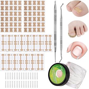 Complete 152-delige pedicureset voor ingegroeide teennagels met nagelcorrectiestickers en vijlen