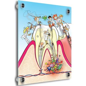 Tandarts Cartoon op plexiglas - Uniek ontwerp - Roland Hols - Doorsnede kies - 90 x 120 cm - 5 mm dik - inclusief 4 afstandhouders chroom (zilverkleurig) - Decoratie - Orthodontist - Mondhygiënist
