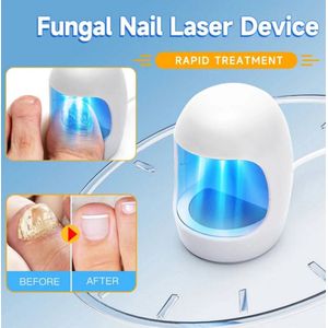Nagelschimmelbehandelingsapparaat – LED Licht voor Beschadigde, Verkleurde en Dikke Teennagels & Vingernagels, Remedie tegen Nagelschimmelinfectie, Voetverzorging, Nagelverzorging, Antischimmel Behandeling