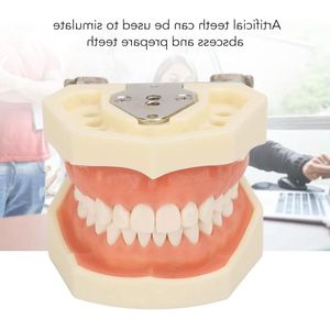 Maxillaire cyste tandheelkundige model met 28 tanden en zacht tandvlees voor oefenen van incisie en abces behandeling. Perfect voor tandheelkundig onderwijs.