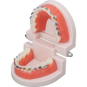 Tandheelkundige Demonstratie Model Typodont Met Orthodontische Metalen Beugel voor Tandarts Onderwijs en Onderzoek
