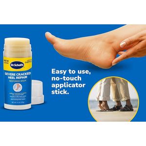 Dr. Scholl's zware gebarsten hielreparatiebalsem 70 g met 25% ureum voor droge- gebarsten voeten- geneest en hydrateert voor gezond uitziende voeten- voetverzorging-Huidverzorging –Scholl –Scholl Velvet Smooth-Epsom-zout kalmeert- veilig voor diabeti