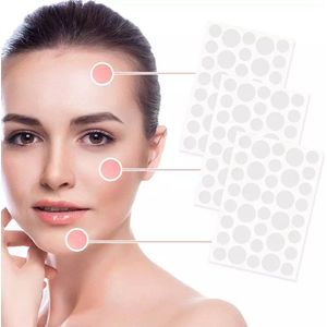Pimple patches - Acne patches - Pimple patch - puisten pleisters - acne pleister - 108 stuks