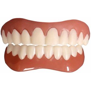 Simulatiebeugels Tijdelijke Prothesen- Birect Kunstgebitten