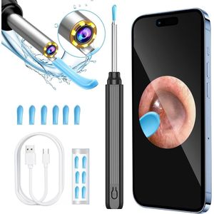 Lexium Oorsmeerverwijderaar met Camera - Oorreiniger – Ear Cleaner – Oren Schoonmaken – Oorsmeer verwijderen
