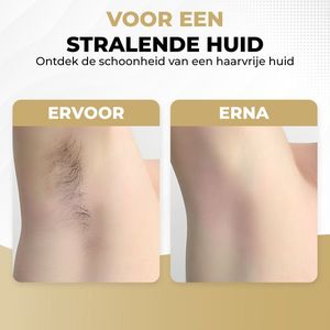 IPL - Ontharingsapparaat - Zwart - 999.999 Flitsen + Gratis Zonnebril & Scheermes