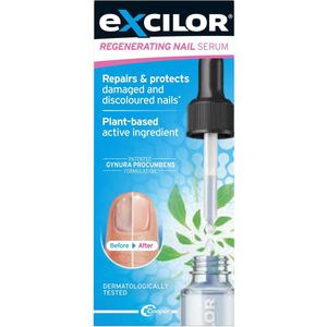 Excilor Regenererend Nagelserum - Herstel de gezondheid van je broze, verkleurde of beschadigde nagels - Dermatologisch getest - Plantaardig actief ingrediënt - 10 ml