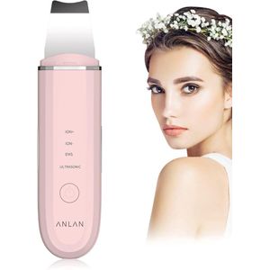 Ultrasone Huid Scrubber - 4 in 1 Gezichtsreiniging en Exfoliatie