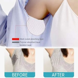 Anti transpirant okselpads - Tegen zweetvlekken - Anti zweet okselpads - Zweet bescherming