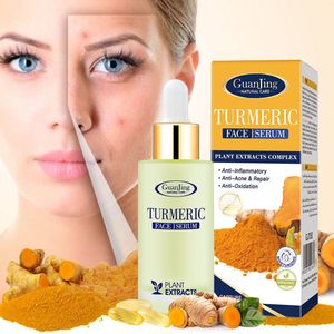 Turmeric gezichtsserum | Turmeric serum | Kurkuma serum | Gezicht Serum | Serum | Kurkuma Gezichtsserum | Kurkuma