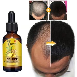 Ginger Hair Growth Serum - Stimuleert Haargroei, Voedt en Hydrateert voor Sterk, Dik en Lang Haar - Anti-Haaruitval Oplossing met Gemberextract - Versterkt Haarwortels - Essentiële Haarverzorging - Voor Alle Haartypes - Langdurige Resultaten - 20 ml