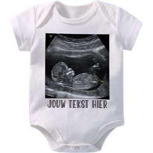 Hospitrix Baby Rompertje met je Eigen Echo Foto en Tekst | 0-3 maanden | Korte Mouw | Cadeau voor Zwangerschap | Bekendmaking | Aankondiging | Aanstaande Moeder | Moederdag