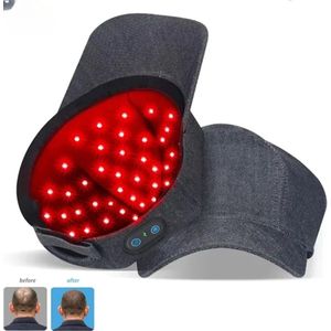 Roodlichttherapie - Infrarood Lichttherapieapparaat - Voor Behandeling Van Haaruitval - 660nm & 850nm Led