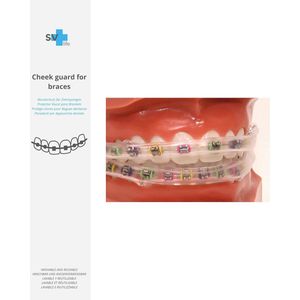 Tandbescherming voor Beugels - Herbruikbare, Transparante Beschermer tegen Aften voor Lippen en Wangen