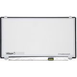 Monitor - LCD - 39,6 inch - 30-pin Aansluiting - Compatibel met Alle Merken