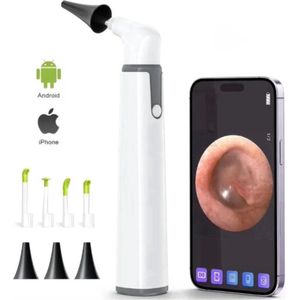 Medj - Otoscoop - oor - endoscoop - oorsmeer verwijderaar - Full HD