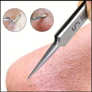 RVS Precisie Pincet – Ultrafijn & Super Scherp – Verwijder Mee-eters, Puistjes en Acne – Professionele Huidverzorging – 11,6 cm