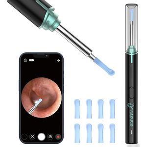 Otoscoop met oorsmeerverwijderaar - 1920P Wifi-oorreiniger - IP67 waterdicht - otoscoopooroor 360° groothoekcamera - LED's - volwassenen kinderen huisdieren