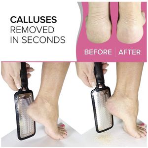 Originele Megafile professionele voetvijl, pedicure-eeltvijl. Zeer scherp, extra grote rasp met veel microvijlen. Verwijder ruwe droge eelt in enkele seconden. Roze of zwart.