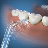 Waterpik JT-100 - Jet Tips - Opzetstuk Voor Waterflossers - 2 Stuks - Zilver