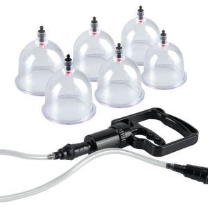 Beginners Cupping Set - 6 Delig