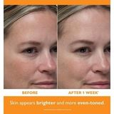 Peter Thomas Roth Potent-C Power Serum Verhelderende Anti-Rimpel Serum 30 ml
