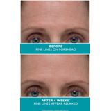 Peter Thomas Roth - Peptide 21 - Rimpelweerstand Serum - 30 ml