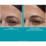 Peter Thomas Roth - Peptide 21 - Gezichtscrème - 50 ml