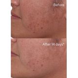 Murad - Rapid Dark Spot Correcting Serum - 30 ml