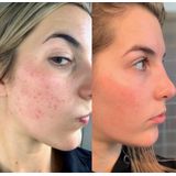 The Ordinary Retinol% Anti Verouderingsserum