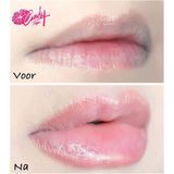 CandyLipz Rode Single Lobed Plumper Lipvergroter Zuignap - Lip plumper - Compact formaat