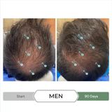 Revita.cbd Super Antioxidant Hair Stimulating Conditioner - Antioxidační Kondicionér Proti Vypadávání Vlasů 205ml