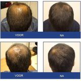 FOLIGAIN - Anti-Haaruitval Shampoo - 236 ml - Voor Mannen