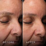 Medik8 - H.E.O. Mask - Gezichtsmasker - 2x50ml