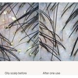 Living Proof - Scalp Care Density Exfoliator - 100ml