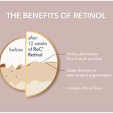 RoC - Retinol Correxion - Nacht Serum Capsules - 30 Stuks