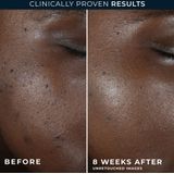 RoC - MULTI CORREXION® Even Tone + Lift Nachtcrème - 50 ml - Huidverzorging