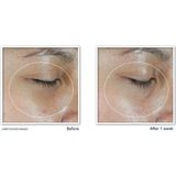 ROC Revive + Glow - Oogcrème - 4 G - Hypoallergeen - Parfumvrij