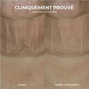 RoC - Derm Correxion - Serumstick - 30 gram