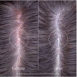 Klorane - Shampoo - Extra Mild - Compact Ontwerp - Gemakkelijk Mee Te Nemen