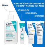 CeraVe - Acne Control Gel - Gezichtsverzorging - 100% Echt - Geïmporteerd uit VS
